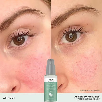 REN Clean Skincare Evercalm Redness Relief Serum Fast-Acting to Reduce and Relieve Redness Calm Sensitive Skin 30ml